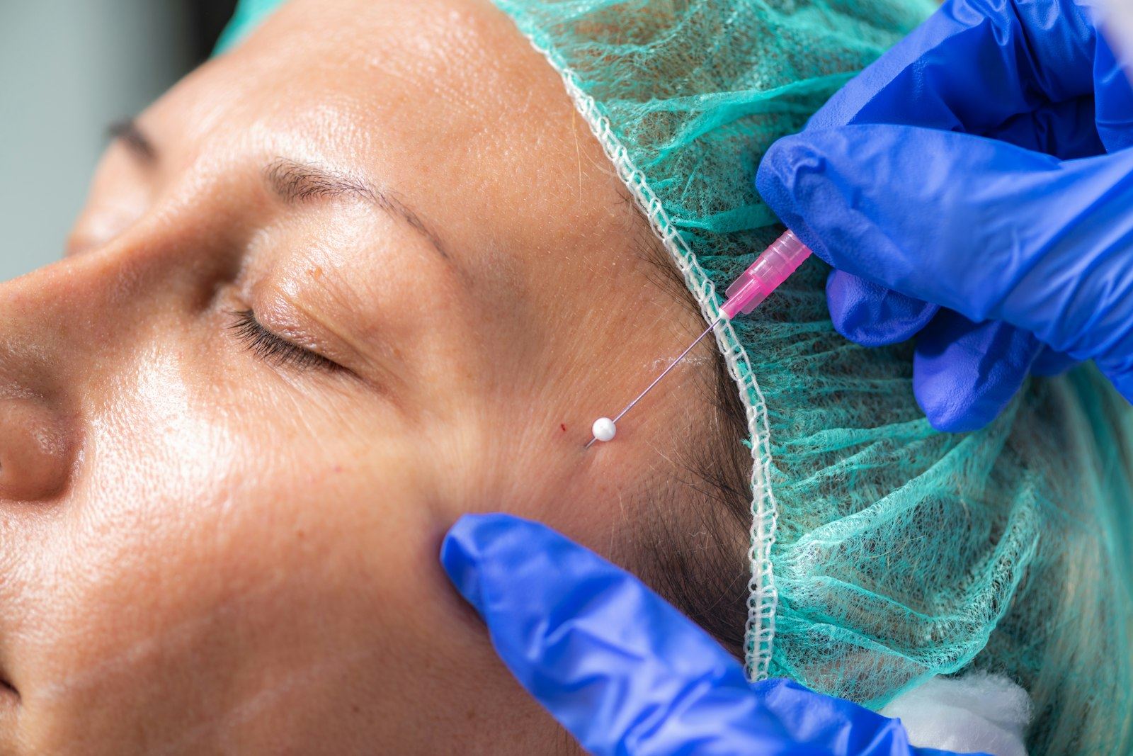 Med spa aesthetic treatment